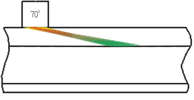 (c) Echo-technique with 70 deg. probe forward and backward